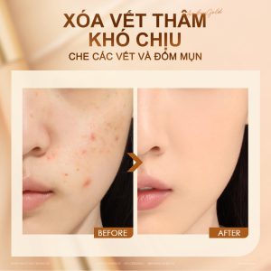 Kem che khuyết điểm Focallure xóa vết thâm